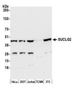 SUCLG2 Antibody in Western Blot (WB)