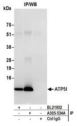 ATP5I Antibody in Immunoprecipitation (IP)