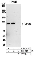 VPS18 Antibody in Immunoprecipitation (IP)