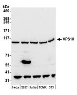 VPS18 Antibody in Western Blot (WB)