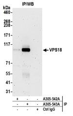 VPS18 Antibody in Immunoprecipitation (IP)