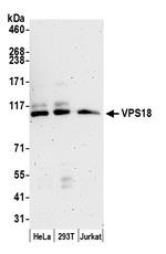 VPS18 Antibody in Western Blot (WB)