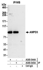 AMPD3 Antibody in Immunoprecipitation (IP)