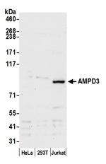 AMPD3 Antibody in Western Blot (WB)