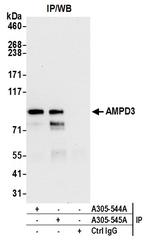 AMPD3 Antibody in Immunoprecipitation (IP)