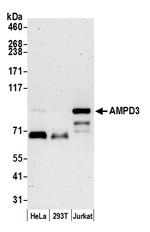 AMPD3 Antibody in Western Blot (WB)