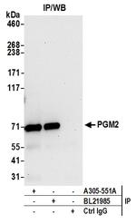 PGM2 Antibody in Immunoprecipitation (IP)