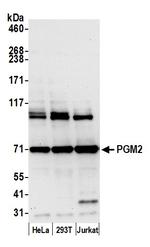 PGM2 Antibody in Western Blot (WB)