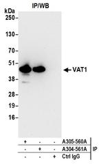 VAT1 Antibody in Immunoprecipitation (IP)