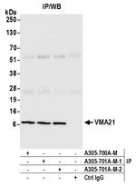 VMA21 Antibody in Immunoprecipitation (IP)