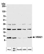 VMA21 Antibody in Western Blot (WB)