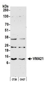 VMA21 Antibody in Western Blot (WB)