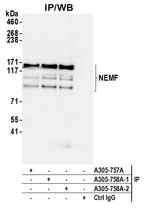 NEMF Antibody in Immunoprecipitation (IP)