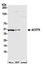 ACOT9 Antibody in Western Blot (WB)