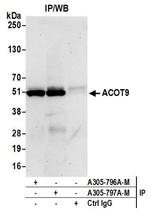 ACOT9 Antibody in Immunoprecipitation (IP)