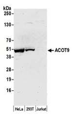 ACOT9 Antibody in Western Blot (WB)