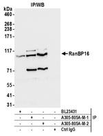 RanBP16 Antibody in Immunoprecipitation (IP)