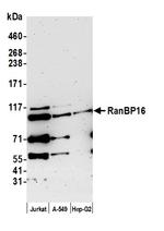 RanBP16 Antibody in Western Blot (WB)