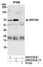 OGFOD1 Antibody in Immunoprecipitation (IP)