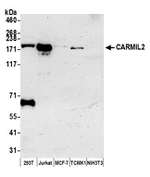 CARMIL2 Antibody in Western Blot (WB)