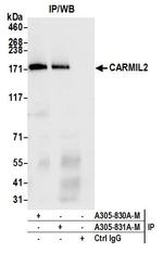 CARMIL2 Antibody in Immunoprecipitation (IP)