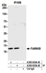 FAM96B Antibody in Immunoprecipitation (IP)