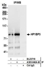 HP1BP3 Antibody in Immunoprecipitation (IP)