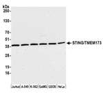 STING/TMEM173 Antibody in Western Blot (WB)