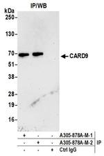 CARD9 Antibody in Immunoprecipitation (IP)