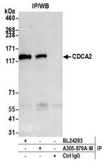 CDCA2 Antibody in Immunoprecipitation (IP)