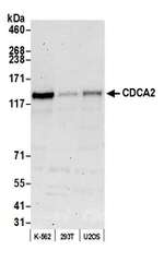 CDCA2 Antibody in Western Blot (WB)