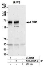 LRIG1 Antibody in Immunoprecipitation (IP)