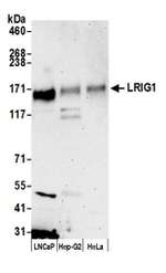 LRIG1 Antibody in Western Blot (WB)