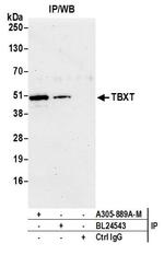 TBXT Antibody in Immunoprecipitation (IP)