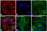 Rabbit IgG (H+L) Highly Cross-Adsorbed Secondary Antibody in Immunocytochemistry (ICC/IF)