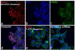 Mouse IgG (H+L) Highly Cross-Adsorbed Secondary Antibody in Immunocytochemistry (ICC/IF)