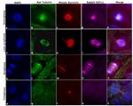 Mouse IgG (H+L) Highly Cross-Adsorbed Secondary Antibody in Immunocytochemistry (ICC/IF)