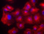 Mouse IgG (H+L) Highly Cross-Adsorbed Secondary Antibody in Immunocytochemistry (ICC/IF)