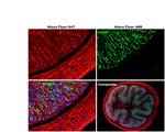 Rabbit IgG (H+L) Highly Cross-Adsorbed Secondary Antibody in Immunohistochemistry (Paraffin) (IHC (P))