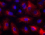 Rabbit IgG (H+L) Highly Cross-Adsorbed Secondary Antibody in Immunocytochemistry (ICC/IF)