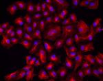 Chicken IgY (H+L) Cross-Adsorbed Secondary Antibody in Immunocytochemistry (ICC/IF)