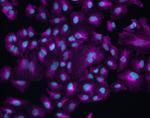 Chicken IgY (H+L) Cross-Adsorbed Secondary Antibody in Immunocytochemistry (ICC/IF)