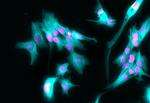 Rabbit IgG (H+L) Highly Cross-Adsorbed Secondary Antibody in Immunocytochemistry (ICC/IF)