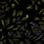 Rat IgG (H+L) Highly Cross-Adsorbed Secondary Antibody in Immunocytochemistry (ICC/IF)