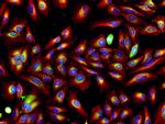 Rat IgG (H+L) Highly Cross-Adsorbed Secondary Antibody in Immunocytochemistry (ICC/IF)