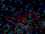 Rat IgG (H+L) Highly Cross-Adsorbed Secondary Antibody in Immunocytochemistry (ICC/IF)