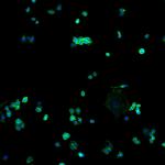 Human IgG (H+L) Cross-Adsorbed Secondary Antibody in Immunocytochemistry (ICC/IF)