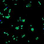 Human IgG (H+L) Cross-Adsorbed Secondary Antibody in Immunocytochemistry (ICC/IF)