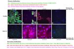 Human IgG (H+L) Cross-Adsorbed Secondary Antibody