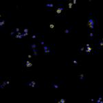 Human IgG (H+L) Cross-Adsorbed Secondary Antibody in Immunocytochemistry (ICC/IF)